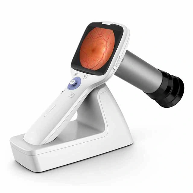 Hfc-600 China Hot Sale Ophthalmic Equipment Portable Handheld Retinal Fundus Camera