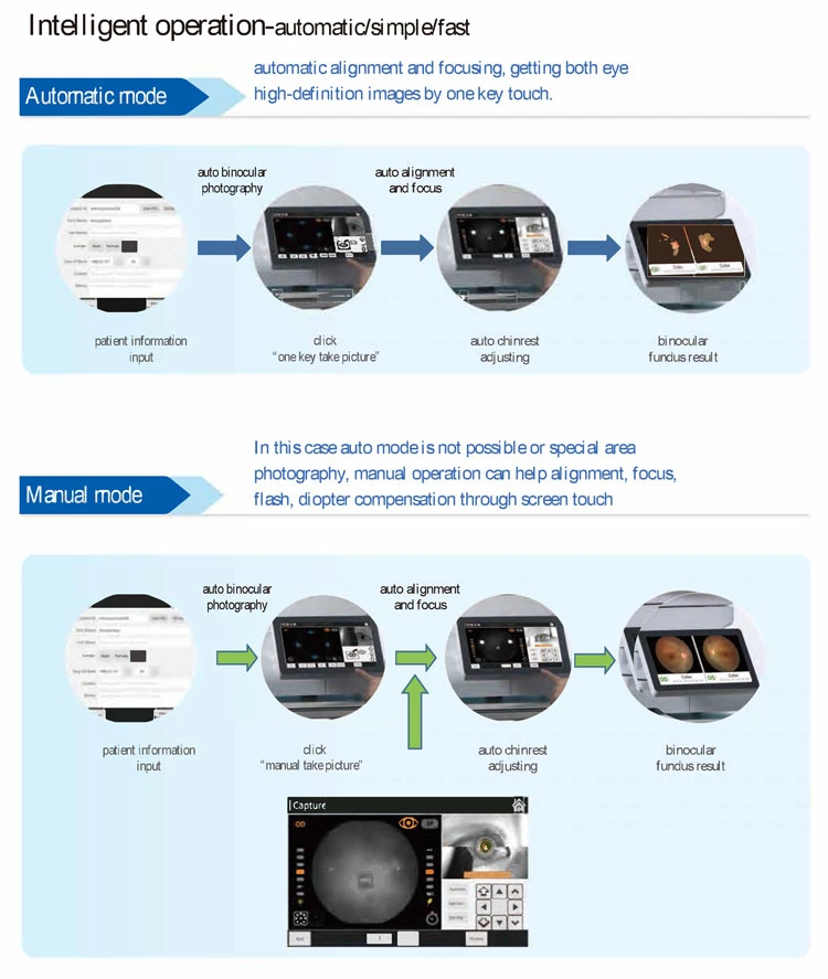 My-V036D Medical Optical Instruments Non Mydriatic Retinal Eye Fundus Camera Ophthalmology