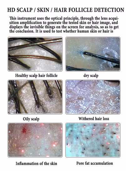 Macchina per l'analisi dei capelli del cuoio capelluto del viso con software mobile wireless quattro