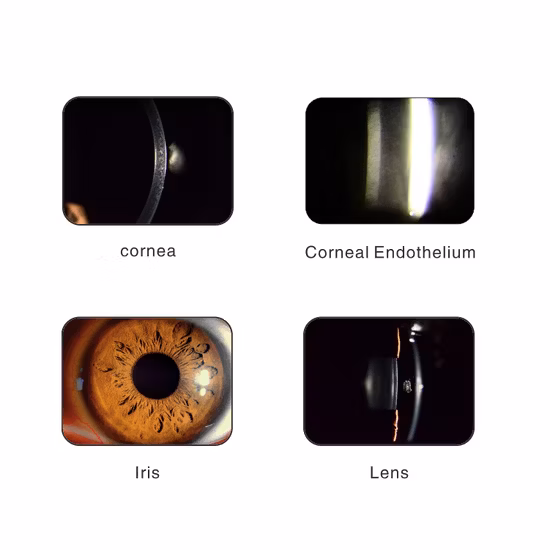 Lampada a fessura digitale portatile per fotocamera oftalmica di alta qualità